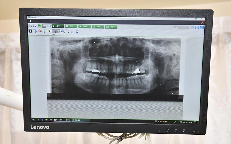 口腔外科を専門とした経験と技術力