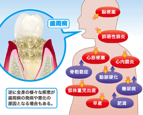 全身疾患との関係